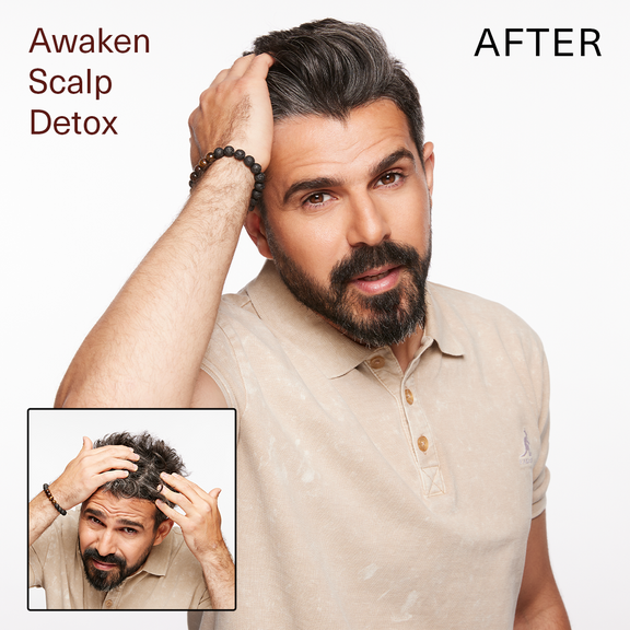 AWAKEN SCALP DETOX Surface Hair